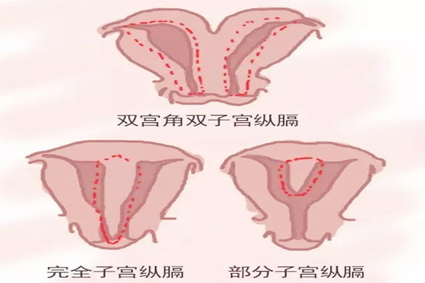 双子宫图结构示意图图片