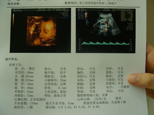 四维胎儿照看男女图解图片